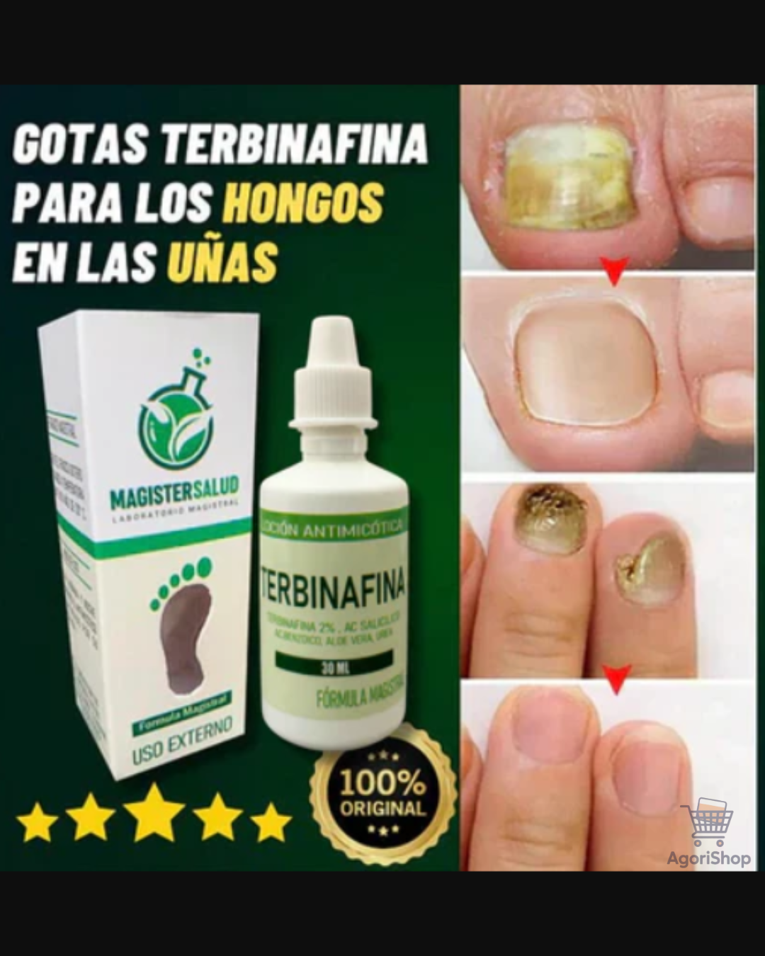 Antihongos Total – Gotas Terbinafina 8%