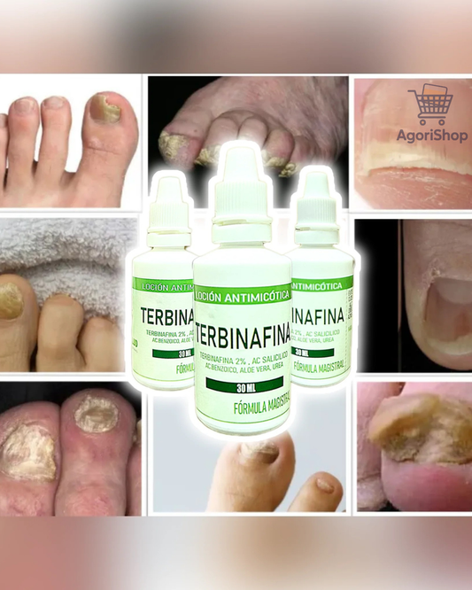 Antihongos Total – Gotas Terbinafina 8%